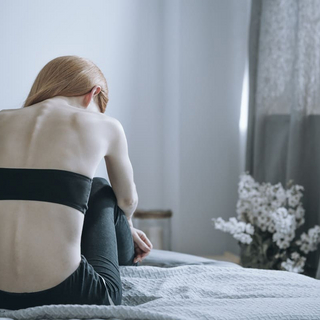 Eine junge Frau mit Magersucht sitzt auf einem Bett, mit dem R&uuml;cken zur Kamera.