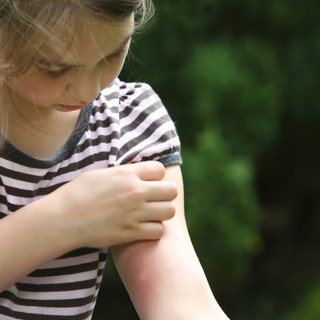 M&auml;dchen kratzt ihren M&uuml;ckenstich